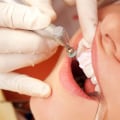 How Dental Hygienists Help Prevent Gum Disease and Tooth Decay
