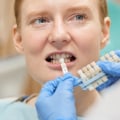 The Role Of Dental Hygienists In Ensuring The Longevity Of Dental Crowns In Manassas, VA