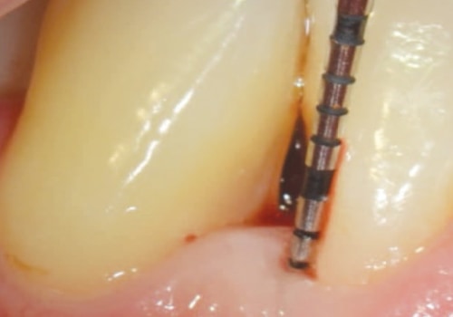 Understanding Risk Assessment and Management Strategies in Oral Health Care Delivery Systems